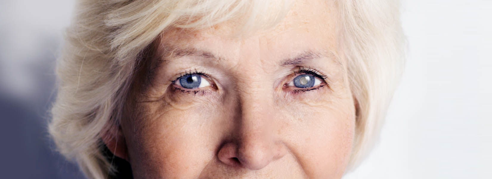 Cataract Surgery in Beatrice